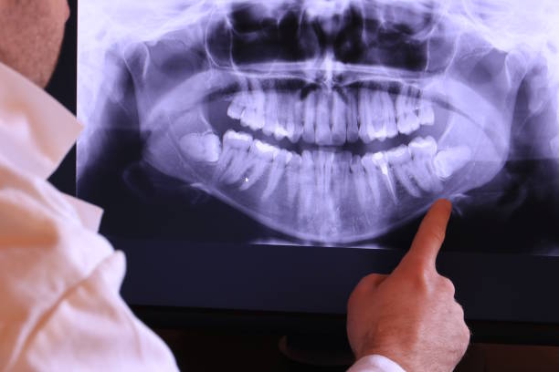 Best Emergency Denture Repair in Benbrook, TX