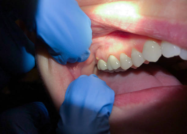 Best Cosmetic Emergency Dentistry in Benbrook, TX